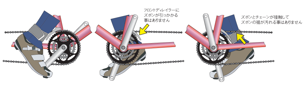 ズボンバンド装着の場合