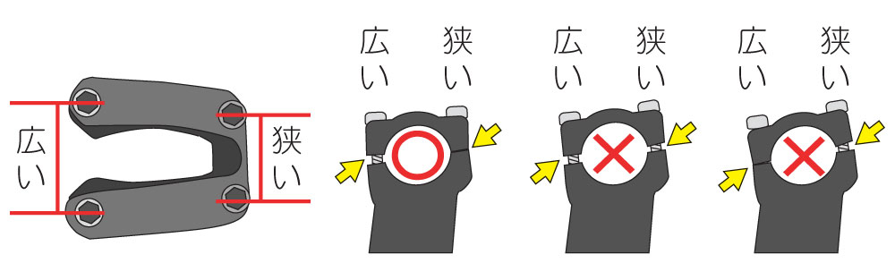 アッパーキャップを固定します